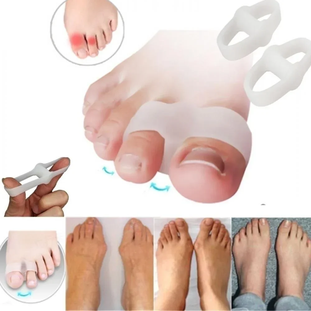 2 Holes Bunion Corrector Pain  - Correction Fluid White avaliação e preço
